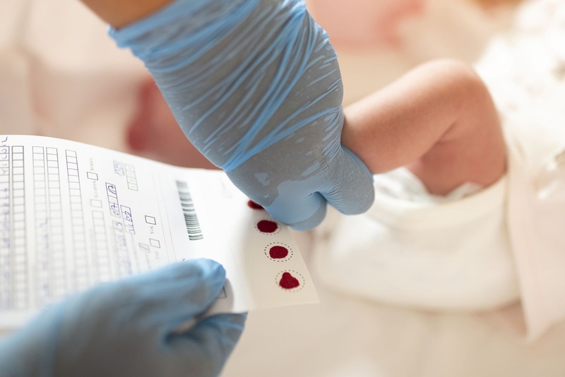 Phenylketone niệu (PKU): Nguyên nhân, triệu chứng và điều trị 4