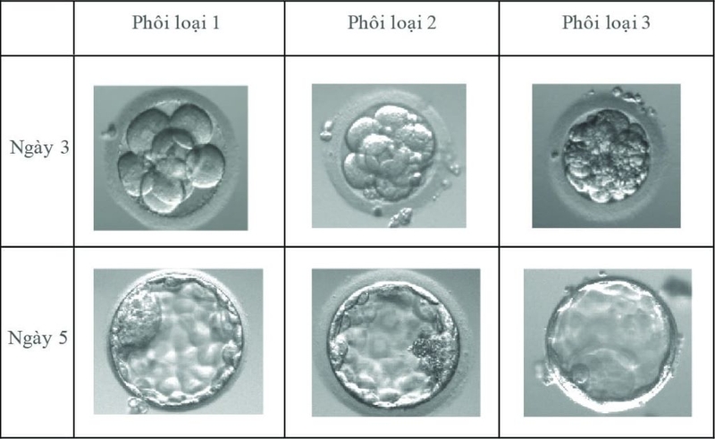 Phôi loại 1 2 3 là gì? Cách phân loại và chọn lựa phôi trong IVF 2
