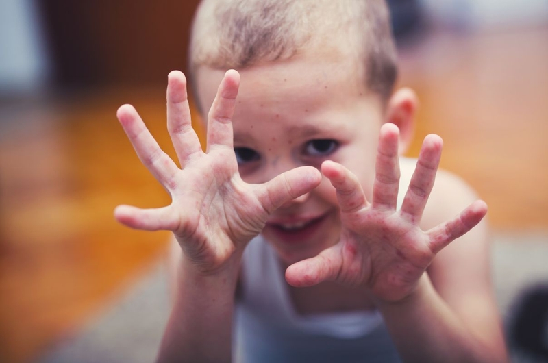 Cách phòng chống bệnh tay chân miệng chủ động và hiệu quả 1