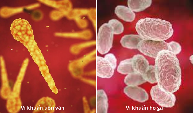 Bệnh ho gà uốn ván