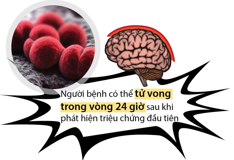 phòng tránh viêm màng não tái phát 2