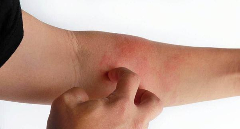 Cách dùng cây vòi voi chữa viêm da cơ địa hiệu quả 3