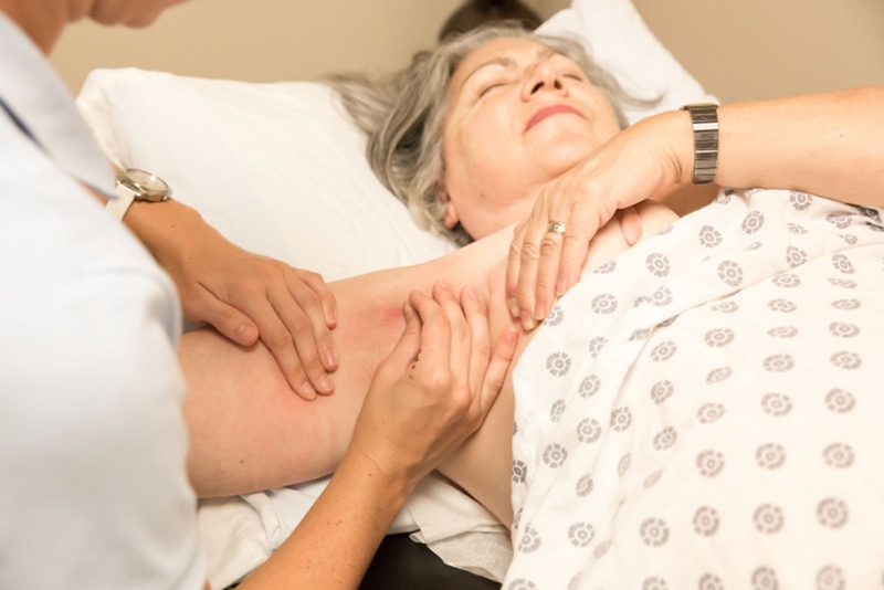 Phù bạch mạch sau khi điều trị ung thư vú nguyên phát là gì?1