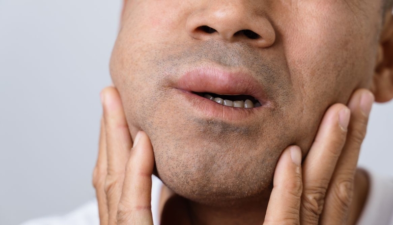 Phù mạch do thuốc: Nguyên nhân, triệu chứng và cách xử lý 1