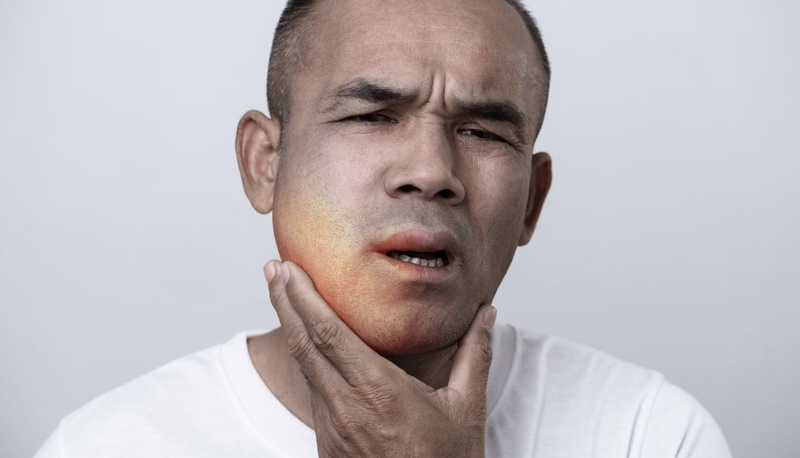 Phù mạch do thuốc: Nguyên nhân, triệu chứng và cách xử lý 3