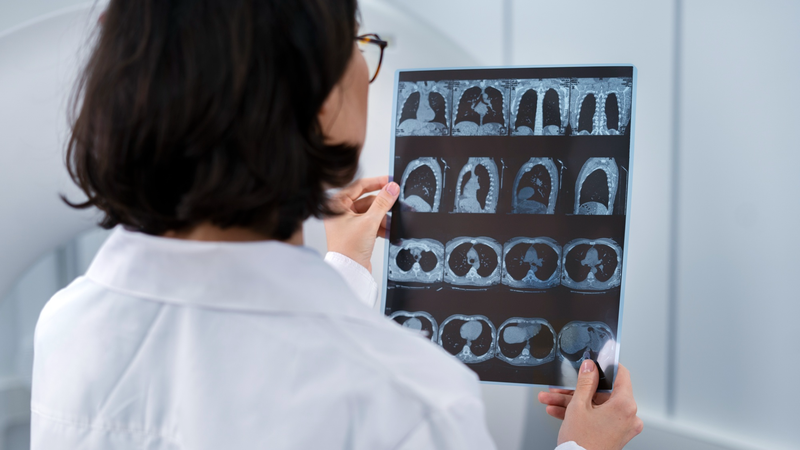 Phù não: Đừng chờ đến khi đau đầu dữ dội mới đi viện 2