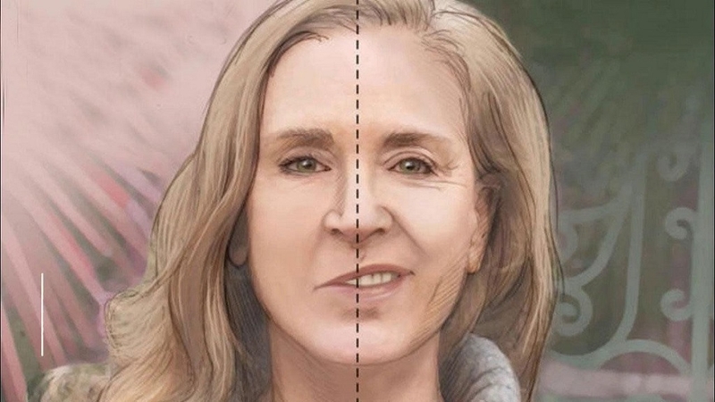 Phù não sau đột quỵ có nguy hiểm không? Nguyên nhân và cách điều trị 2