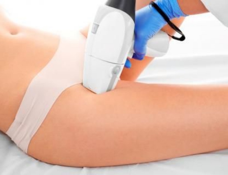 Phụ nữ đang có kinh đi triệt lông được không? Cách chăm sóc vùng da sau triệt lông 1