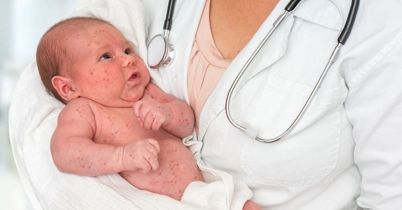 Phụ nữ sau sảy thai bao lâu thì tiêm phòng rubella được? 3