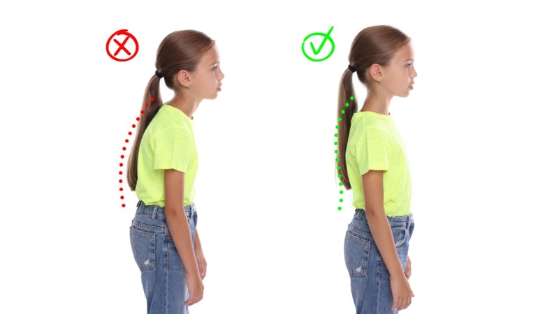 Phục hồi chức năng vẹo cột sống giúp kiểm soát và cải thiện tình trạng