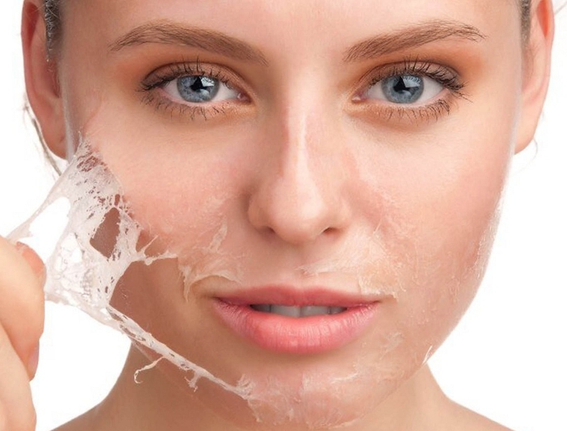 Cách phục hồi da bị bào mòn mà cô nàng nào cũng có thể thực hiện 1
