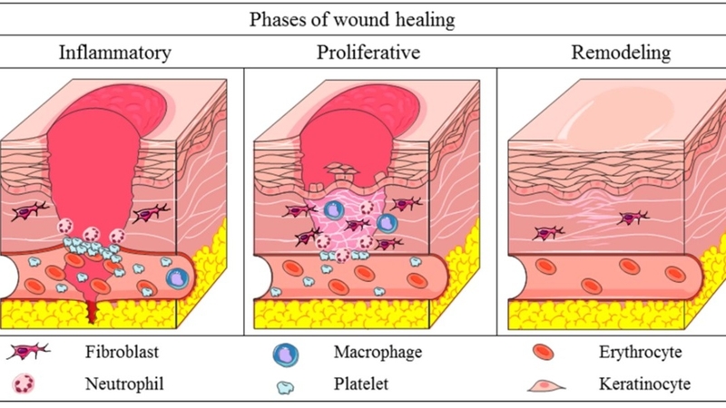 Phục hồi da nhờ yếu tố tăng trưởng và các vấn đề có liên quan 1