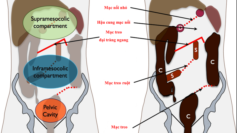 Phúc mạc là gì? Bệnh viêm phúc mạc có nguy hiểm không? 2