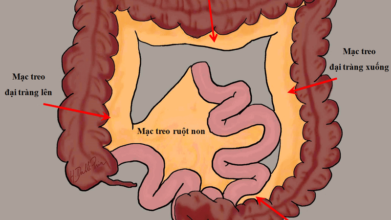 Phúc mạc là gì? Bệnh viêm phúc mạc có nguy hiểm không? 3