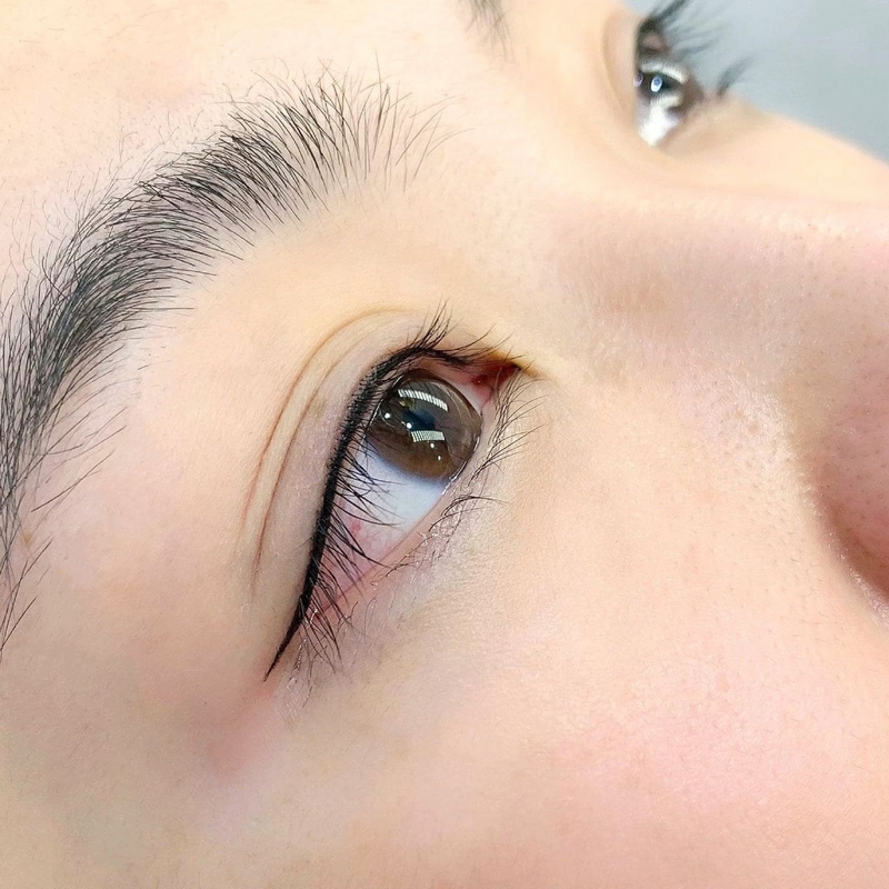 Phun mí mở tròng giá bao nhiêu? Có an toàn không và những lưu ý cần biết