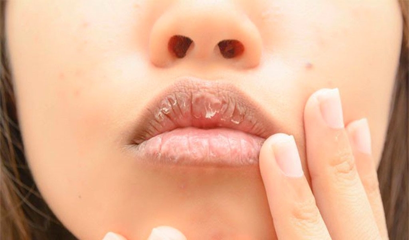 Phun môi tế bào gốc là gì? Ưu điểm vượt trội của phương pháp này là gì? 1