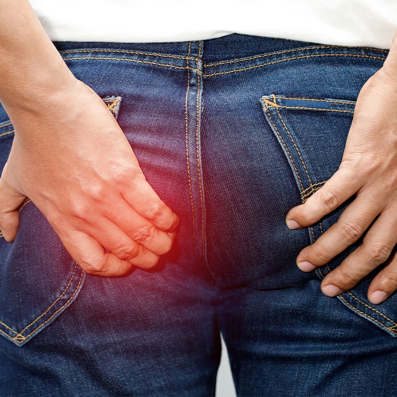 Phương pháp cắt trĩ milligan morgan là gì?3