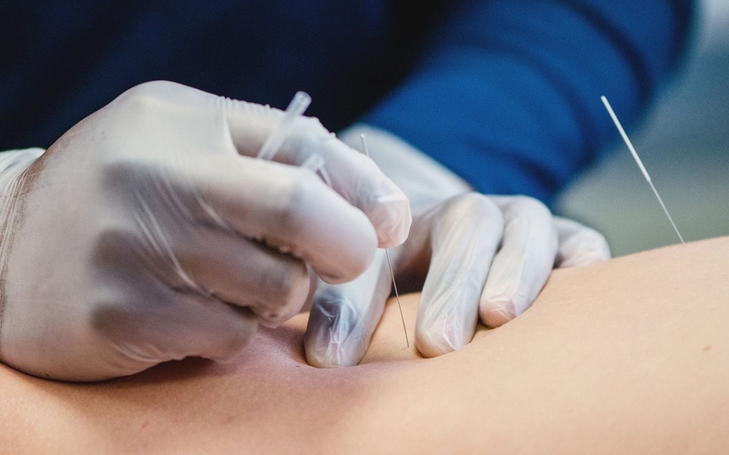 Phương pháp cấy chỉ chữa bệnh xương khớp 3