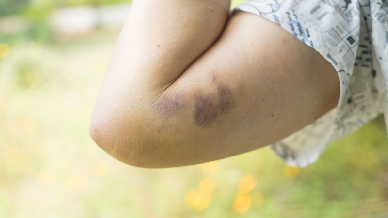 Phương pháp chẩn đoán điện giúp phát hiện bệnh gì? Có nhược điểm nào không? 3