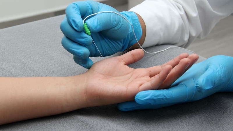 Phương pháp chẩn đoán điện giúp phát hiện bệnh gì? Có nhược điểm nào không? 4