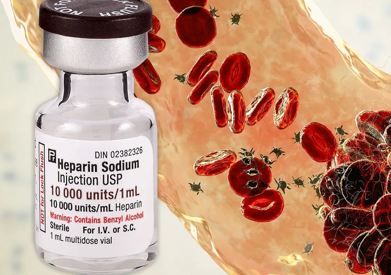 Phương pháp chẩn đoán và điều trị huyết khối tĩnh mạch nội sọ 4