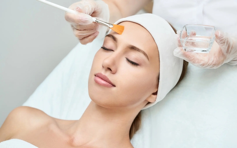 Phương pháp Chemical Peel trị mụn cực kỳ hiệu quả 2