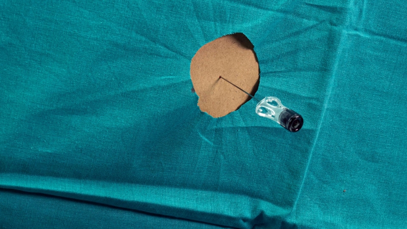 Phương pháp chọc tủy xét nghiệm viêm màng não có an toàn không? 2