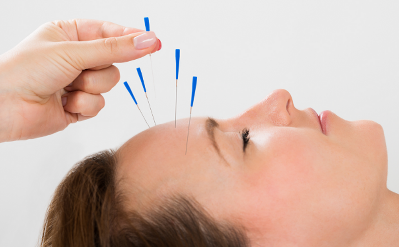 Phương pháp chữa méo miệng liệt mặt