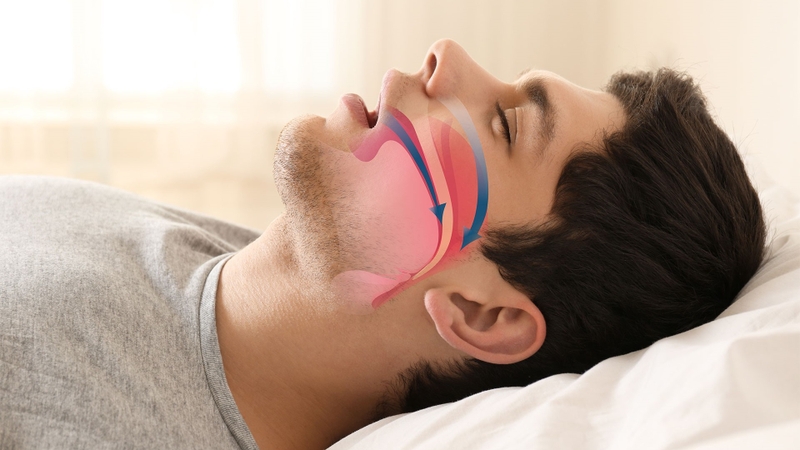 Phương pháp điều trị thay thế thuốc cho rung nhĩ hiện nay 2