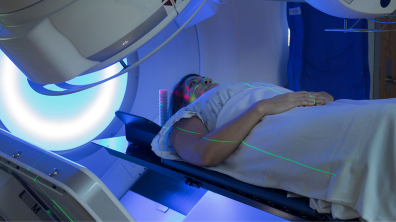 Xạ trị ung thư gan và một số phương pháp điều trị ung thư gan khác 1