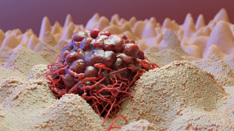 Phương pháp điều trị ung thư mới và những điều cần biết về điều trị ung thư 1