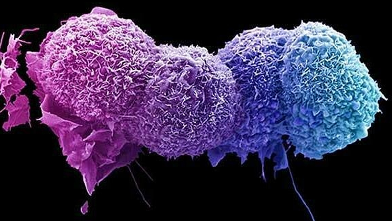 Thử nghiệm lâm sàng ngăn sự phát triển của các tế bào ung thư di căn