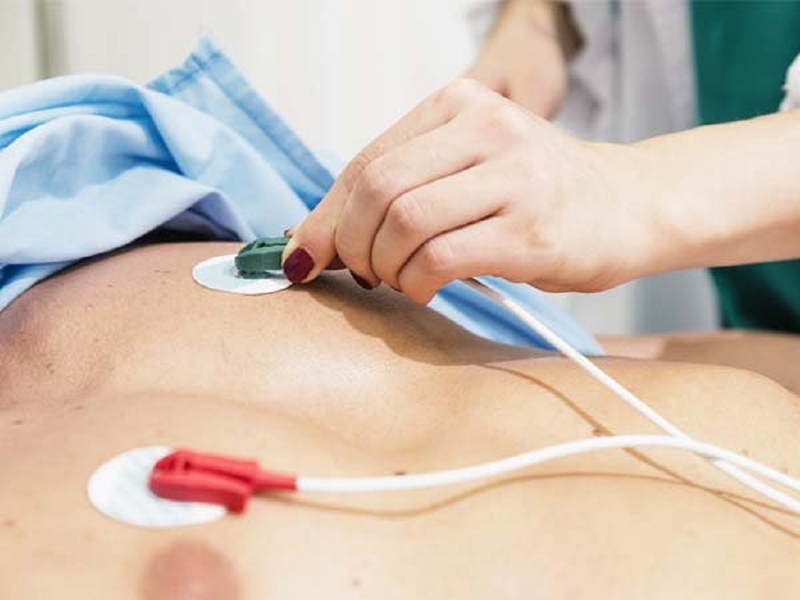 Phương pháp đo ECG là gì? Nguyên lý và quy trình các bước đo ECG 3
