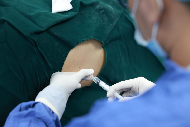 Phương pháp gây tê ngoài màng cứng là gì? 1