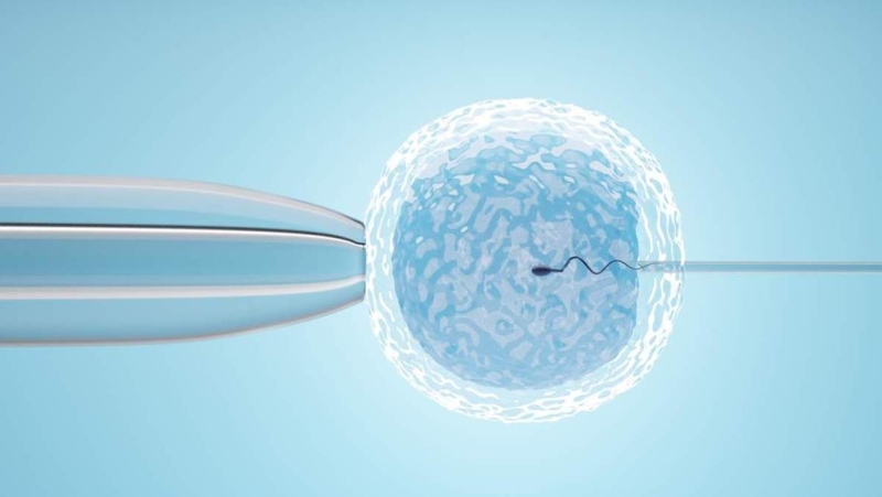 Phương pháp IMSI – Kỹ thuật chọn lọc tinh trùng cho IVF/ICSI 1