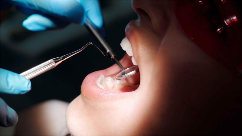 Phương pháp nhổ răng bằng Piezotome và những điều mà bạn nên biết 1