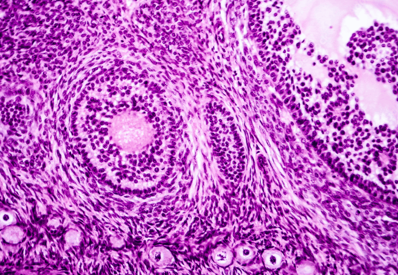 Phương pháp nhuộm 2 màu hematoxylin eosin để làm gì? 2