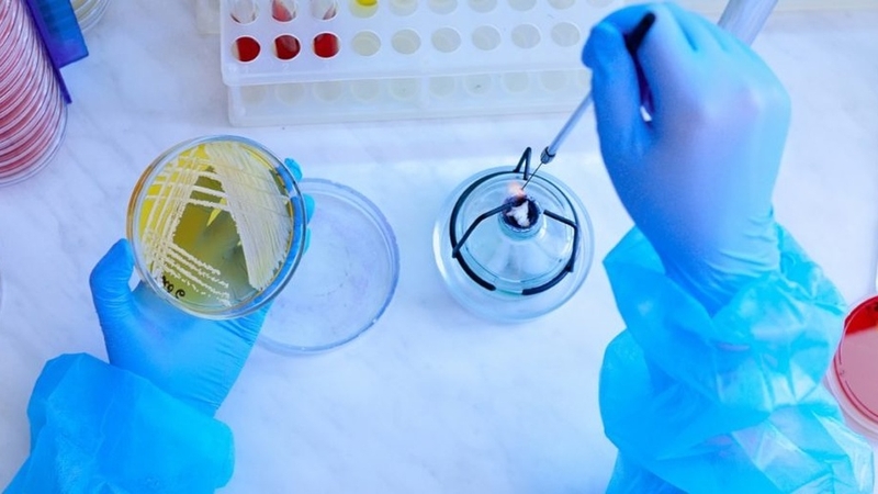 Phương pháp phân lập vi sinh vật và những điều cần biết 3