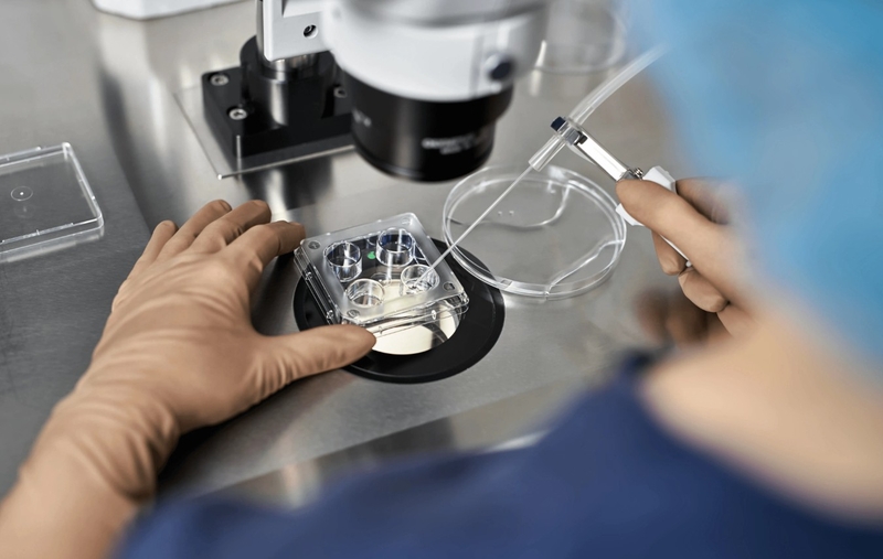 Phương pháp ROSI và những điều có thể bạn chưa biết 2