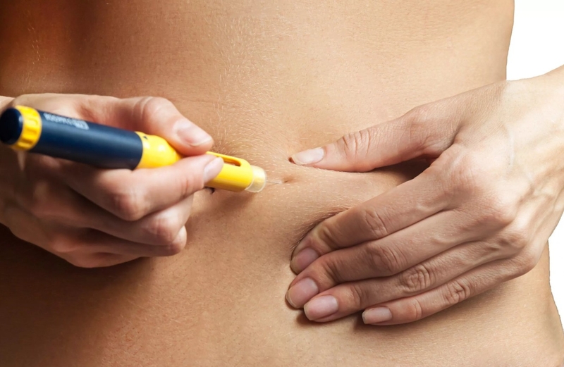 Phương pháp ROSI và những điều có thể bạn chưa biết 3