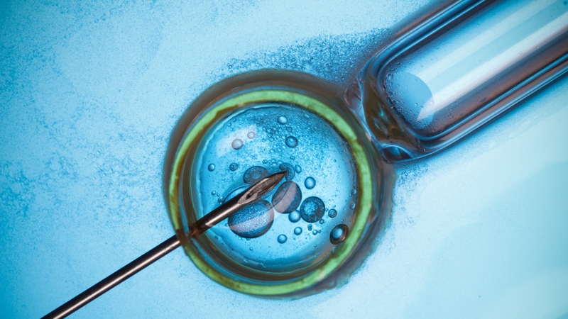 Phương pháp ROSI và những điều có thể bạn chưa biết 4