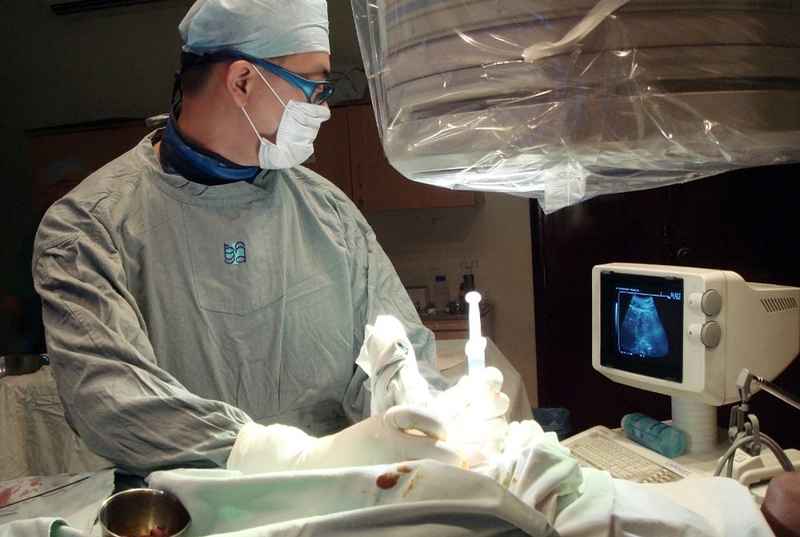 Phương pháp TACE là gì? Ưu và nhược điểm của TACE trong điều trị ung thư gan