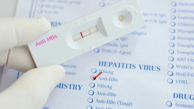 Phương pháp test nhanh viêm gan B có chính xác không? 1