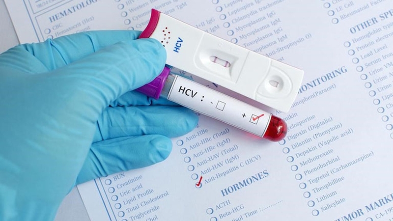 Phương pháp test nhanh viêm gan B có chính xác không? 2