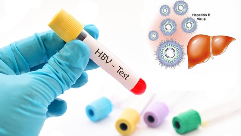 Phương pháp test nhanh viêm gan B có chính xác không? 3