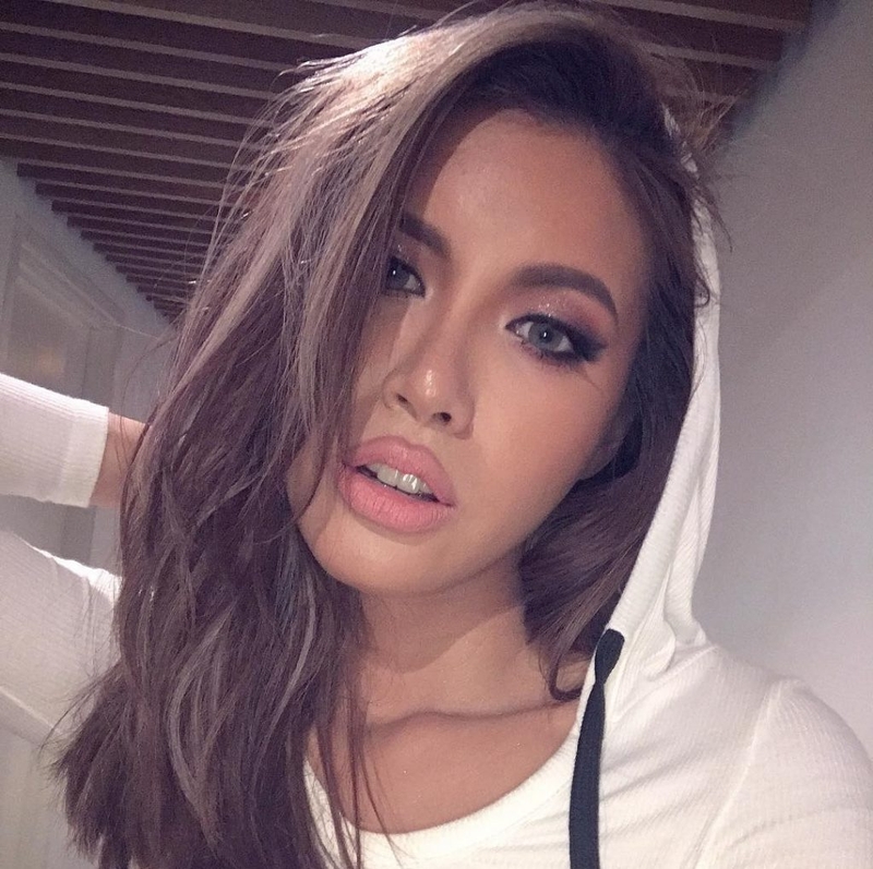 Tiêm filler môi tều