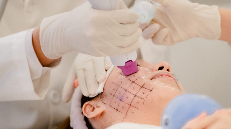 Công nghệ trẻ hóa da thermage FLX giúp da săn chắc, đàn hồi