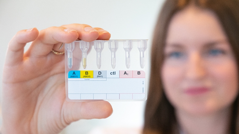 Phương pháp Western blot là gì? Ứng dụng trong y khoa và sinh học 2