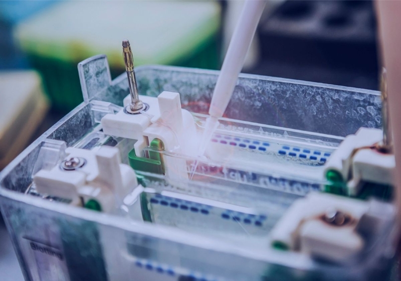 Phương pháp Western blot là gì? Ứng dụng trong y khoa và sinh học