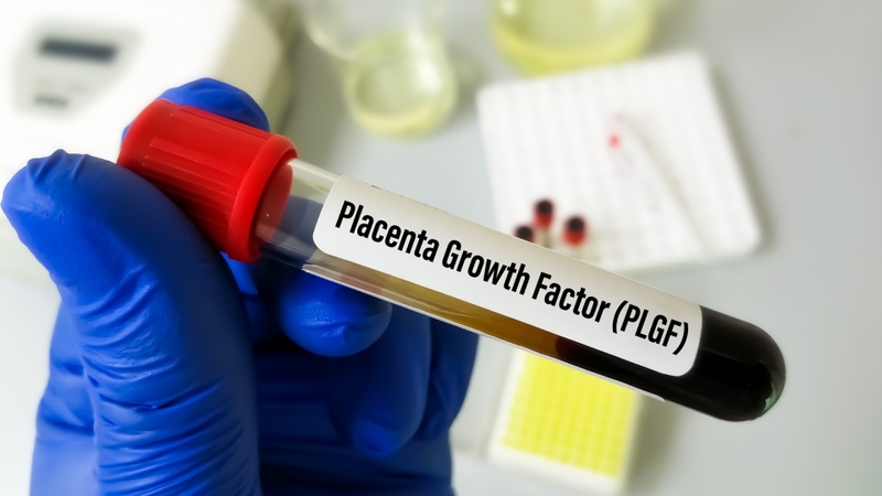 PLGF là gì? Vai trò của Placental Growth Factor trong thai kỳ và bệnh lý sản khoa 1